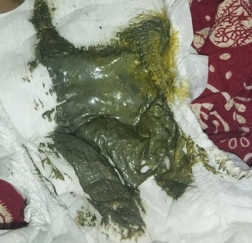 Pup bayi warna hijau apakah aman?