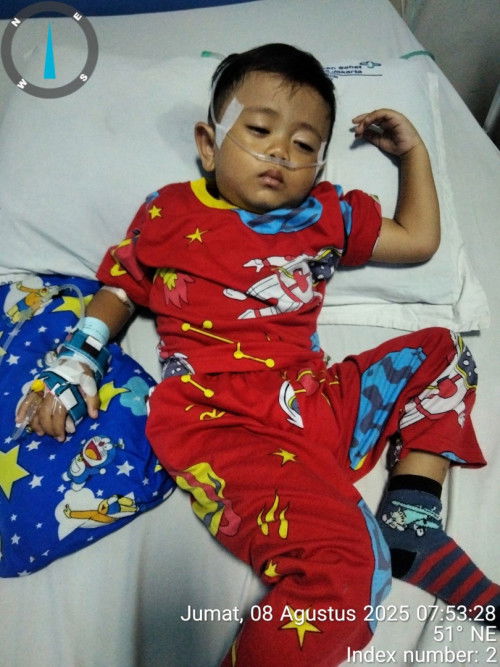 Kejeledak berujung di rawat inap