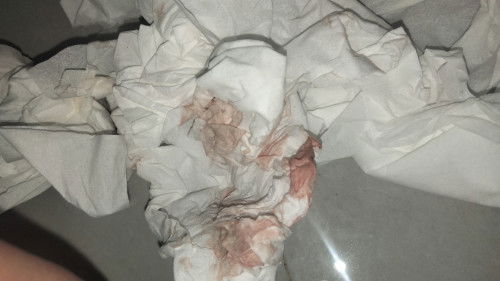 Hamil 7 minggu 2 hari