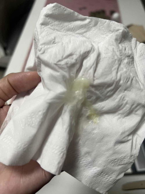 Discharge or Mucus Plug