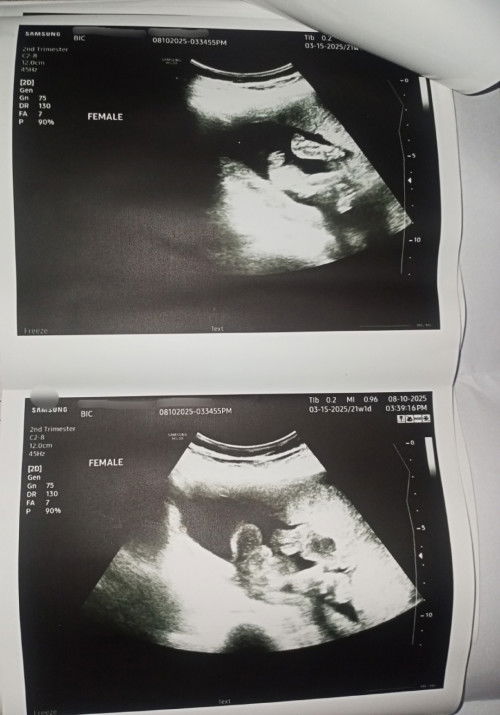 Gender Confirmation: Is it 100% Female?