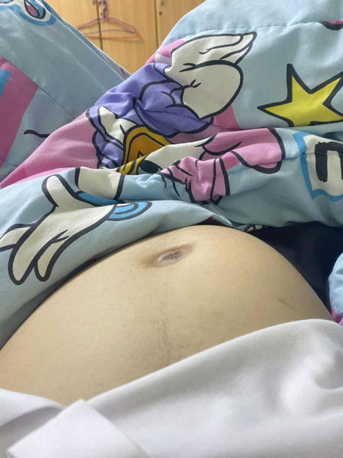 29+2week ท้องแข็งเบี้ยว