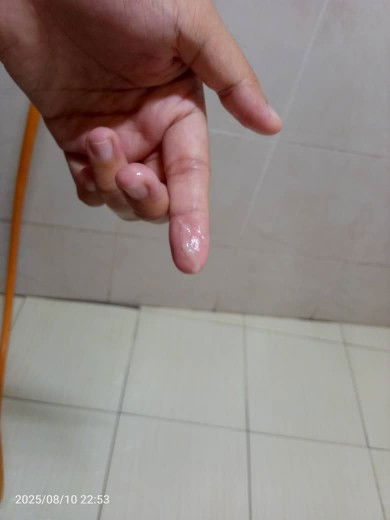 Assalamualaikum mintak maaf pada gambar yang tak menyenangkan just nak tahu..
