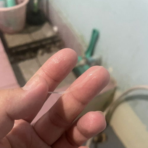 ใช่มูกใสมั้ยคะแม่ๆ