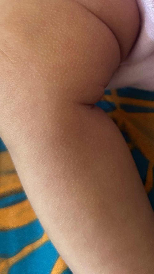 Tolong solusinya moms🙏🏻