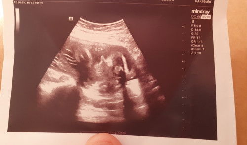 Boy or girl ?