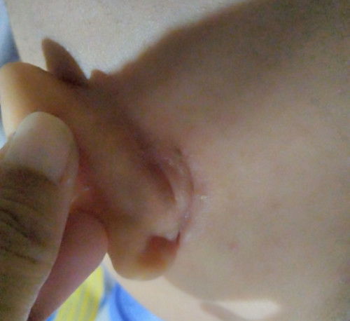Masalah pada belakang telinga bayi