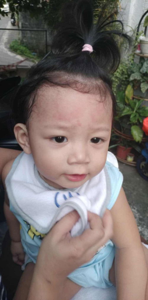 TEETHING STAGE