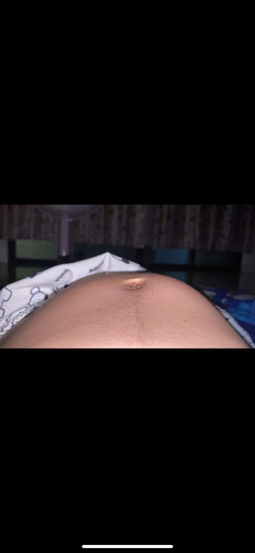 นูนข้างเดียวคือน้องโก่งตัวใช่มั้ยคะ