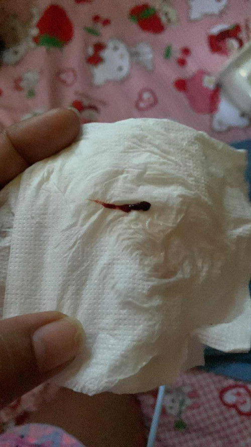 38+5 มีเเบบนี้ต้องไปหาหมอเลยไหมคะ