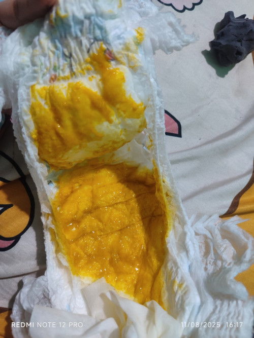 Hallo bunda, mungkin ada yg pernah punya pengalaman seperti aku, jadi mungkin bisa saling sharing ya