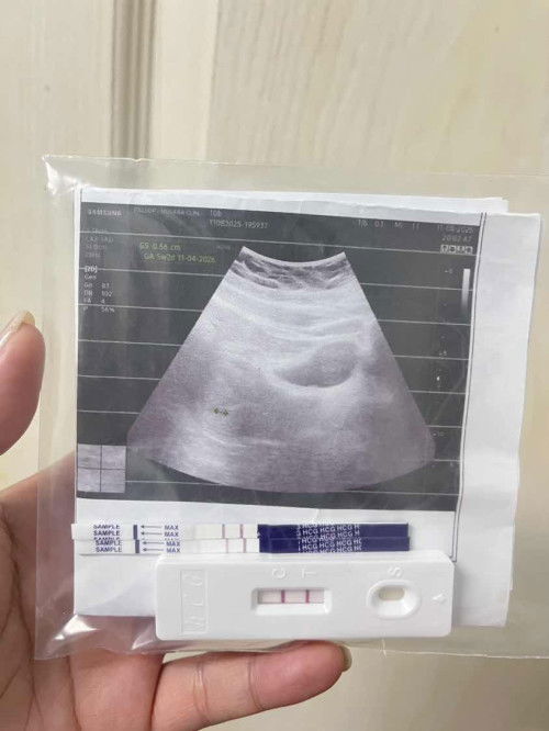 5 week ยังไม่เจอตัวน้องเลยค่ะ กังวลมากๆ