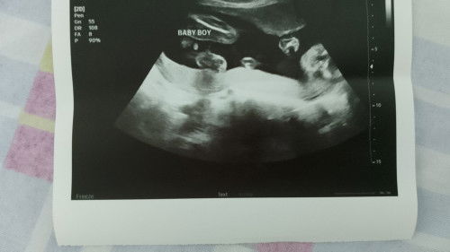 Saan ba banda madetermine na its a boy?