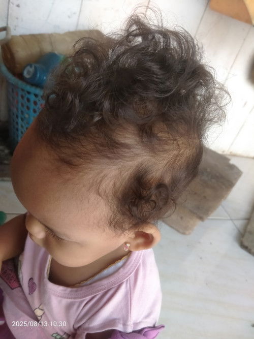 Rambut anak