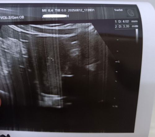 Ada ke macam saya...