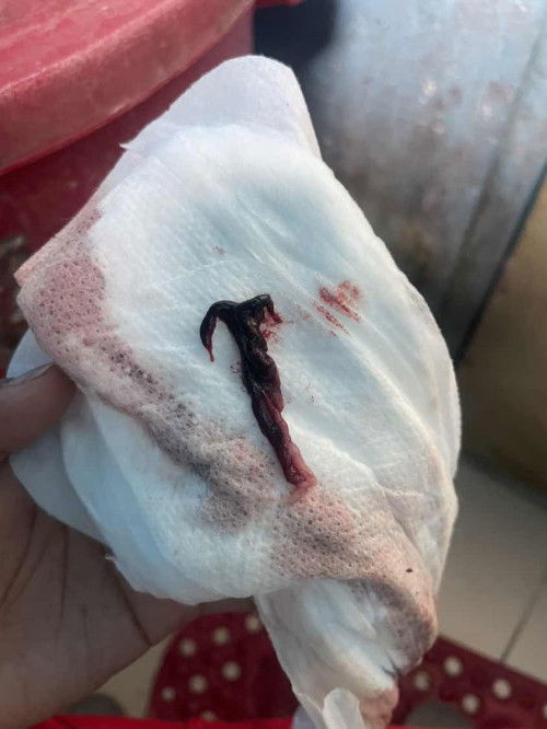Blood Cloth