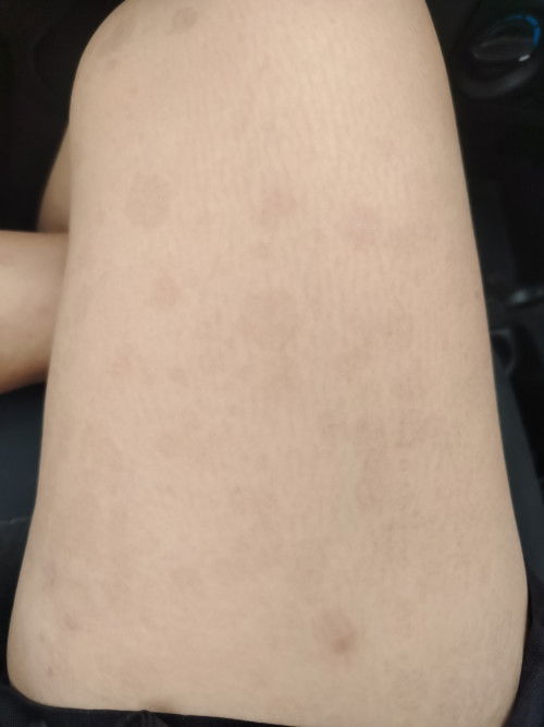Macam mana nak hilangkan ni?tahu tak? Sebelum pregnant takda pun benda ni? Tolong mom