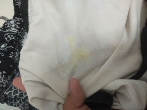 มีมูกหลังกระตุ้นคลอดแต่สีเขียวปนเหลือง