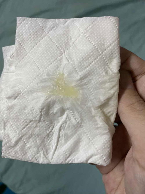 Ra dịch nhầy