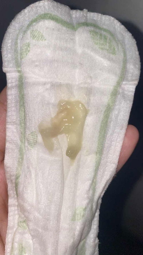 Tanda tanda nak bersalin ke?