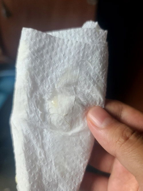 Mucus plug