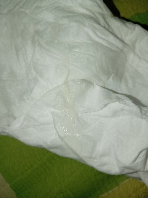 Keputihan atau mucus plug?