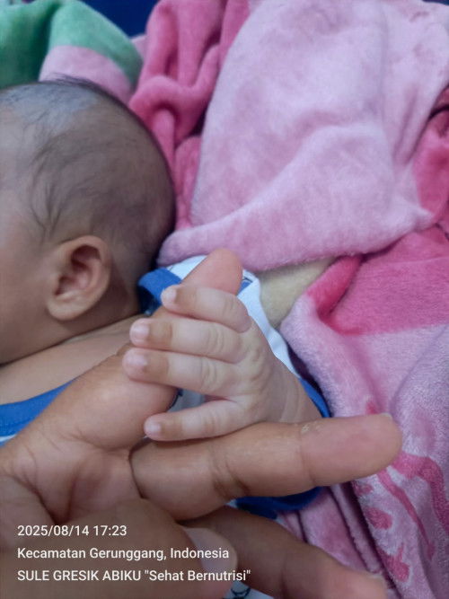 Apakah normal warna ujung-ujungnya jari bayi tampak kehitaman sperti ini?