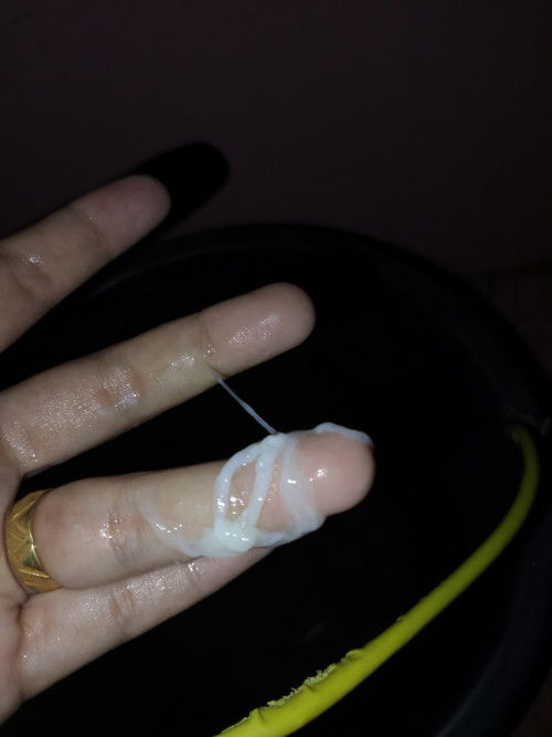 Bunda bunda hamil 19 week keputihan seperti ini normal g ya tapi tidak merasakan gatal atau sakit