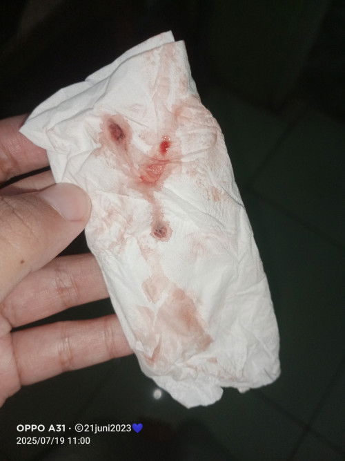 Assalamu alaikum bun ini flek hamil atau flek haid ya anak saya baru umur 4 bln soal nya