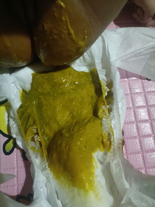 Fases bayi
Apakah ini normal Bun fullasi