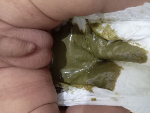 Bayi minum Sufor lactogen bab berwarna hijau