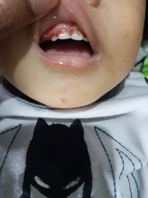 Gigi anak roheng yg deket gusinya