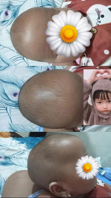 Bentuk kepala tidak bulat