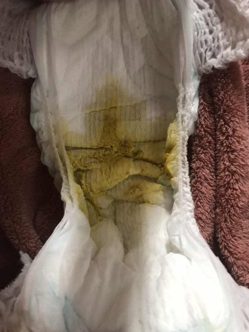 Anak bayi 2 bulan 12 hari bab 5x sehari