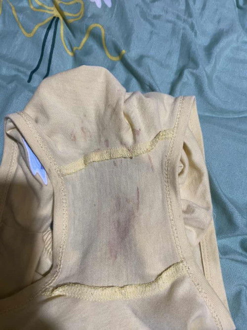 Lite blood vaginal discharge