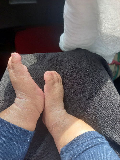 Baby  2minggu lagi nak masuk 6bulan