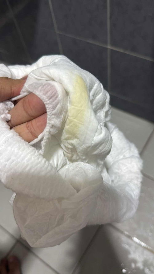 Yellow discharge 12 weeks pregnancy