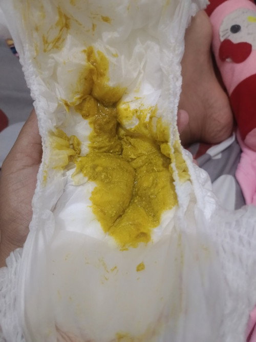 Diare gak ya bun