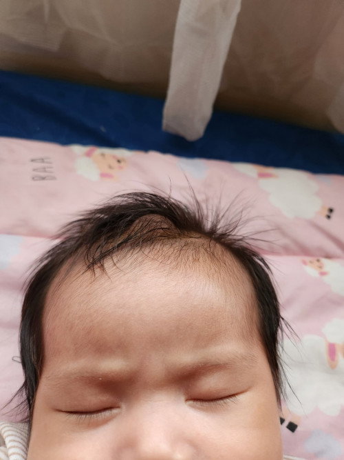 Tonjolan di kepala anak