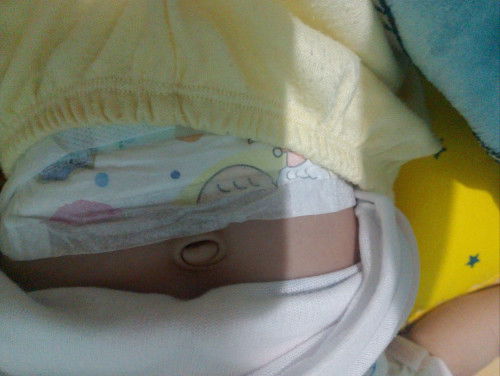 Mau tanya bund , pusar bayi seperti ini bodong atau tidak ya?