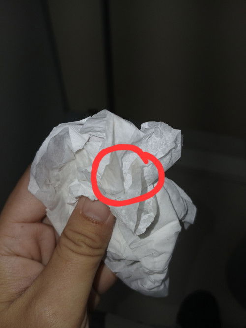 ใช่มูกเลือดมั้ยคะ?