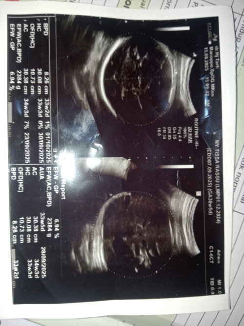 BBJ 36w masih 2,3, gimana nih bunda. Apa ada yg pernah kayak aku gini