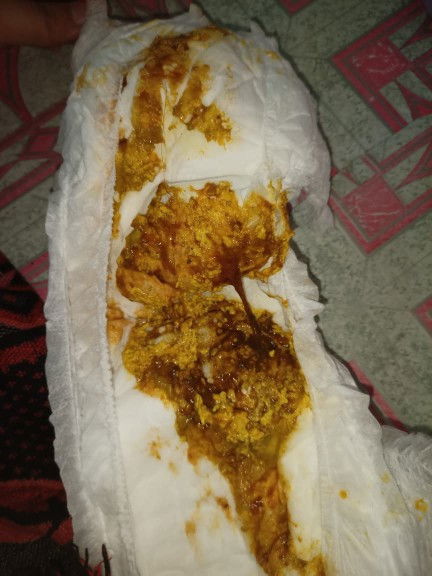 PUP BAYI MULAI MPASI