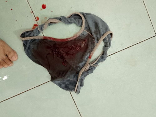 Bleeding 6 minggu