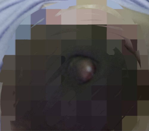 ตั้งครรภ์ 12 วีค มีตุ่มสีขาวปลายจุกนม