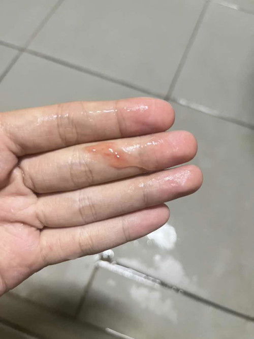 อยากจะทราบว่าอันที่ใช่อาการตั้งครรภ์มั้ยค่ะ