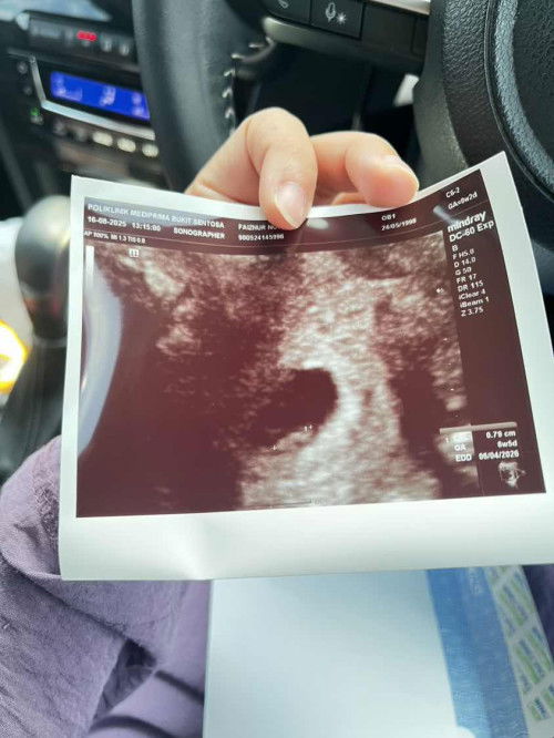 Ukuran Scan berbeza dengan LMP
