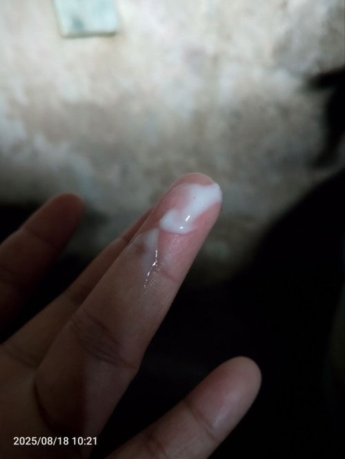 Hello everyone! First time mom here, ano ibig Sabihin ng white discharge? 2months palang akong preg.