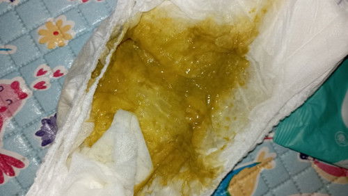 Pup bayi 4 bulan setelah imunusasi dpt 3