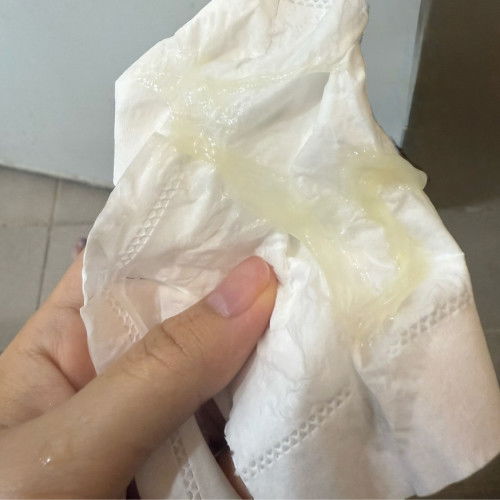มูกแบบนี้ใกล้คลอดหรือยังคะแม่ๆ 33 สัปดาห์